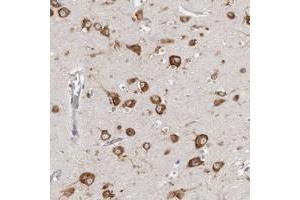 Immunohistochemical staining of human cerebral cortex with FAM167B polyclonal antibody  shows strong cytoplasmic positivity in neuronal cells.