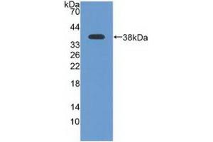 Detection of Recombinant ATR, Human using Polyclonal Antibody to Ataxia Telangiectasia And Rad3 Related Protein (ATR) (ATR antibody  (AA 2353-2644))