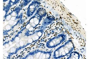 ABIN6263186 and ABIN6273137 at 1/100 staining Rat colorectal tissue by IHC-P.
