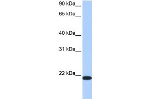 WB Suggested Anti-TMED4 Antibody Titration:  0. (TMED4 antibody  (Middle Region))