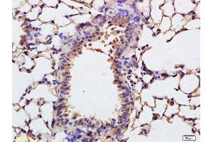 Formalin-fixed and paraffin embedded rat lung labeled with Anti-COL4A3BP Polyclonal Antibody, Unconjugated (ABIN708836) at 1:200 followed by conjugation to the secondary antibody (COL4A3BP antibody  (AA 551-624))