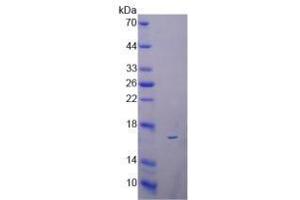 Image no. 2 for Regenerating Islet-Derived 3 beta (REG3B) (AA 27-175) (Active) protein (His tag) (ABIN6239917)