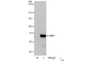 Immunoprecipitation (IP) image for anti-Malic Enzyme 1, NADP(+)-Dependent, Cytosolic (ME1) antibody (ABIN2855777)