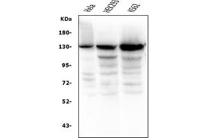 Western blot analysis of BubR1/BUB1B using anti-BubR1/BUB1B antibody (ABIN7600961). (BUB1B antibody  (AA 26-448))