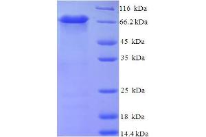 SDS-PAGE (SDS) image for Carboxypeptidase, Vitellogenic-Like (CPVL) (AA 23-476) protein (His-SUMO Tag) (ABIN5711857)