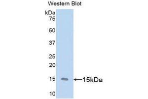 Western Blotting (WB) image for anti-CD59 (CD59) (AA 23-105) antibody (ABIN3206838) (CD59 antibody  (AA 23-105))
