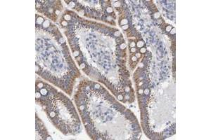 Immunohistochemical staining of human duodenum with ZC3H3 polyclonal antibody  shows moderate cytoplasmic positivity in glandular cells at 1:50-1:200 dilution. (ZC3H3 antibody)