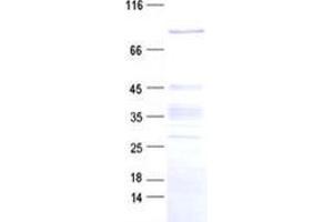 Validation with Western Blot (ZNF226 Protein (His tag))
