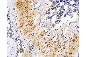 Immunohistochemistry analysis of paraffin-embedded mouse bone using MAGEC1 Polyclonal Antibody at dilution of 1:300.