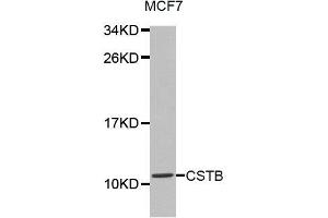 Western Blotting (WB) image for anti-Cystatin B (Stefin B) (CSTB) antibody (ABIN1872053) (CSTB antibody)