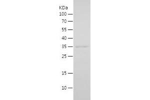 Western Blotting (WB) image for Inhibitor of Growth Family, Member 2 (ING2) (AA 1-280) protein (His tag) (ABIN7123427) (ING2 Protein (AA 1-280) (His tag))