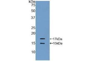 Detection of Recombinant MCP1, Human using Polyclonal Antibody to Monocyte Chemotactic Protein 1 (MCP1)