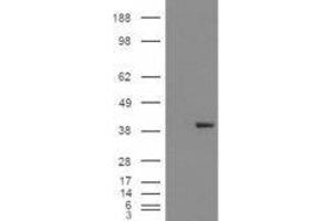 Western Blotting (WB) image for Aldo-Keto Reductase Family 1, Member B1 (Aldose Reductase) (AKR1B1) peptide (ABIN370286) (Aldo-Keto Reductase Family 1, Member B1 (Aldose Reductase) (AKR1B1) Peptide)