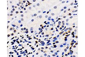 Immunohistochemistry analysis of paraffin-embedded mouse kidney using ERK 2 Polyclonal Antibody at dilution of 1:100. (ERK2 antibody)