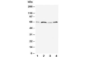 Western blot testing of OPN antibody and Lane 1:  MM231 (Osteopontin antibody  (N-Term))