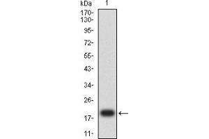 Western blot analysis using MSH2 mAb against human MSH2 (AA: 442-586) recombinant protein. (MSH2 antibody  (AA 442-586))