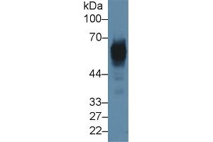 Detection of CK5 in Rat Skin lysate using Polyclonal Antibody to Cytokeratin 5 (CK5) (Cytokeratin 5 antibody  (AA 335-473))
