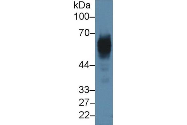 Cytokeratin 5 antibody  (AA 335-473)