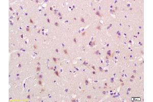 Formalin-fixed and paraffin embedded rat brain labeled with Anti-OB/CDH11/OB-Cadherin Polyclonal Antibody, Unconjugated (ABIN1387539) at 1:200 followed by conjugation to the secondary antibody and DAB staining. (OB Cadherin antibody  (AA 310-360))