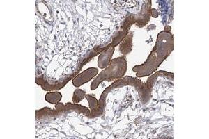 Immunohistochemical staining of human placenta with CPEB4 polyclonal antibody  shows strong membranous and cytoplasmic positivity in trophoblastic cells at 1:200-1:500 dilution. (CPEB4 antibody)