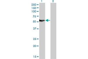 Western Blotting (WB) image for anti-Nuclear Factor I/B (NFIB) (AA 1-421) antibody (ABIN599410) (NFIB antibody  (AA 1-421))