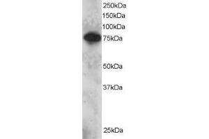 Western Blotting (WB) image for SET Domain and Mariner Transposase Fusion Gene (SETMAR) peptide (ABIN370433) (SET Domain and Mariner Transposase Fusion Gene (SETMAR) Peptide)