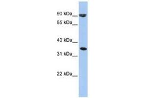 anti-Solute Carrier Family 10 (Sodium/bile Acid Cotransporter Family), Member 7 (SLC10A7) (AA 216-265) antibody
