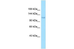WB Suggested Anti-EPHA6 Antibody Titration: 1.