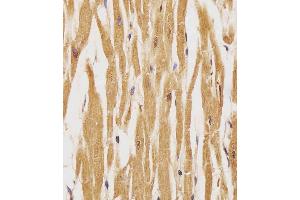 (ABIN389572 and ABIN2839598) staining HER4 in human heart tissue sections by Immunohistochemistry (IHC-P - paraformaldehyde-fixed, paraffin-embedded sections). (ERBB4 antibody  (pTyr1162))