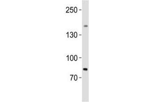 Western blot analysis of lysate from human testis tissue lysate using SALL4 antibody diluted at 1:1000. (SALL4 antibody  (AA 1035-1069))