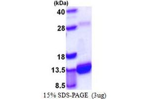 SDS-PAGE (SDS) image for S100 Calcium Binding Protein A4 (S100A4) (AA 1-101) protein (His tag) (ABIN667465) (s100a4 Protein (AA 1-101) (His tag))