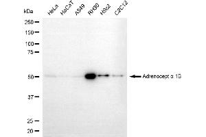 anti-Adrenergic, alpha-1B-, Receptor (ADRA1B) antibody