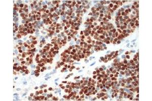 Immunohistochemistry (IHC) image for anti-Myogenin (Myogenic Factor 4) (MYOG) antibody (ABIN953581)