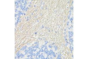 Immunohistochemistry of paraffin-embedded rat brain using CD90/Thy1 antibody (ABIN7266228) at dilution of 1:100 (40x lens). (CD90 antibody  (AA 31-81))