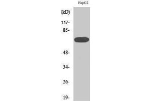 Western Blotting (WB) image for anti-Mitogen-Activated Protein Kinase Kinase Kinase 3 (MAP3K3) (Internal Region) antibody (ABIN3180171) (MAP3K3 antibody  (Internal Region))
