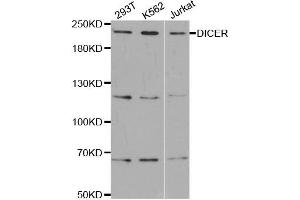 Western Blotting (WB) image for anti-Dicer 1, Ribonuclease Type III (DICER1) antibody (ABIN1877050) (DICER1 antibody)