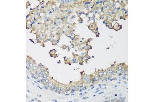 Immunohistochemistry (IHC) image for anti-E3 ubiquitin-protein ligase NEDD4-like (NEDD4L) (AA 836-955) antibody (ABIN6144504)