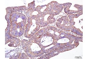 Immunohistochemistry (Paraffin-embedded Sections) (IHC (p)) image for anti-Golgin B1 (GOLGB1) (AA 751-850) antibody (ABIN1714458)