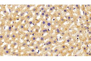 Detection of PLCe1 in Mouse Liver Tissue using Polyclonal Antibody to Phospholipase C Epsilon 1 (PLCe1) (PLCE1 antibody  (AA 1-250))