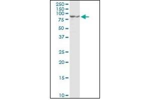 Western Blotting (WB) image for anti-Proprotein Convertase Subtilisin/kexin Type 1 (PCSK1) (AA 652-754) antibody (ABIN781869) (PCSK1 antibody  (AA 652-754))