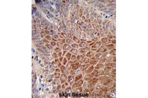 Immunohistochemistry (IHC) image for anti-Immunoglobulin Heavy Chain (IgH) antibody (ABIN2995207) (IgH antibody)