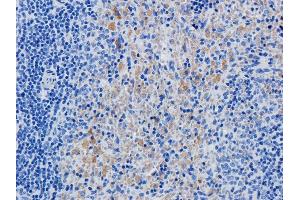 Immunohistochemical staining of rat spleen using anti-IL2R antibody  Formalin fixed rat spleen slices were were stained with  at 5 µg/ml. (Recombinant IL2RA (Daclizumab Biosimilar) antibody)