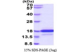 SDS-PAGE (SDS) image for Neurotensin (NTS) (AA 24-148) protein (His tag) (ABIN5854756) (Neurotensin Protein (NTS) (AA 24-148) (His tag))