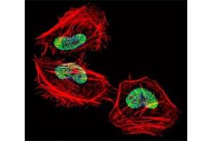 Immunofluorescence (IF) image for anti-Histone Deacetylase 4 (HDAC4) (AA 1049-1077) antibody (ABIN3031231)