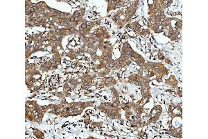 IHC analysis of CBR1 using anti-CBR1 antibody (ABIN7600015). (CBR1 antibody  (AA 14-262))