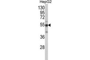 Western Blotting (WB) image for anti-Cytochrome P450, Family 2, Subfamily J, Polypeptide 2 (CYP2J2) antibody (ABIN3003218) (CYP2J2 antibody)
