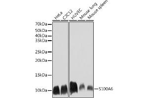Western blot analysis of extracts of various cell lines, using S100 Rabbit mAb (ABIN7270127) at 1:1000 dilution. (S100A6 antibody)