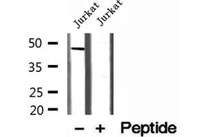 Western blot analysis of extracts of Jurkat cells, using MAGT1 antibody.