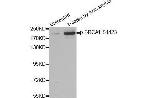 Western blot analysis of extracts from HT29 cells, using Phospho-BRCA1-S1423 antibody (BRCA1 antibody  (pSer1423))