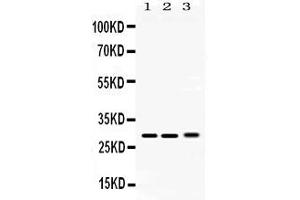 Western blot analysis of PSMA3 expression in rat testis extract ( Lane 1), mouse lung extract ( Lane 2) and 293T whole cell lysates ( Lane 3). (PSMA3 antibody  (Middle Region))